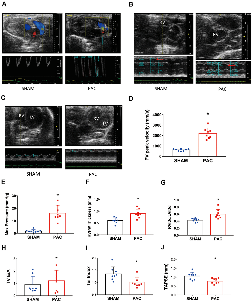 Pulmonary artery constriction induced right ventricular (RV) dysfunction. (A–C) Representative recordings of M-mode echocardiographic images; the red arrows point to the RV chamber. (D) The pulmonary valve (PV) peak velocity. (E) The pulmonary valve (PV) peak pressure. (F) The RV free wall thickness. (G) The ratio of right ventricular diastolic internal diameter to left ventricular diastolic internal diameter (RVIDd/LVIDd). (H) The tricuspid valve (TV) E/A ratio. (I) The RV myocardial performance index (or Tei index). (J) Tricuspid annular plane systolic excursion (TAPSE) in the sham and PAC groups. PAC: Pulmonary artery constriction. *P 