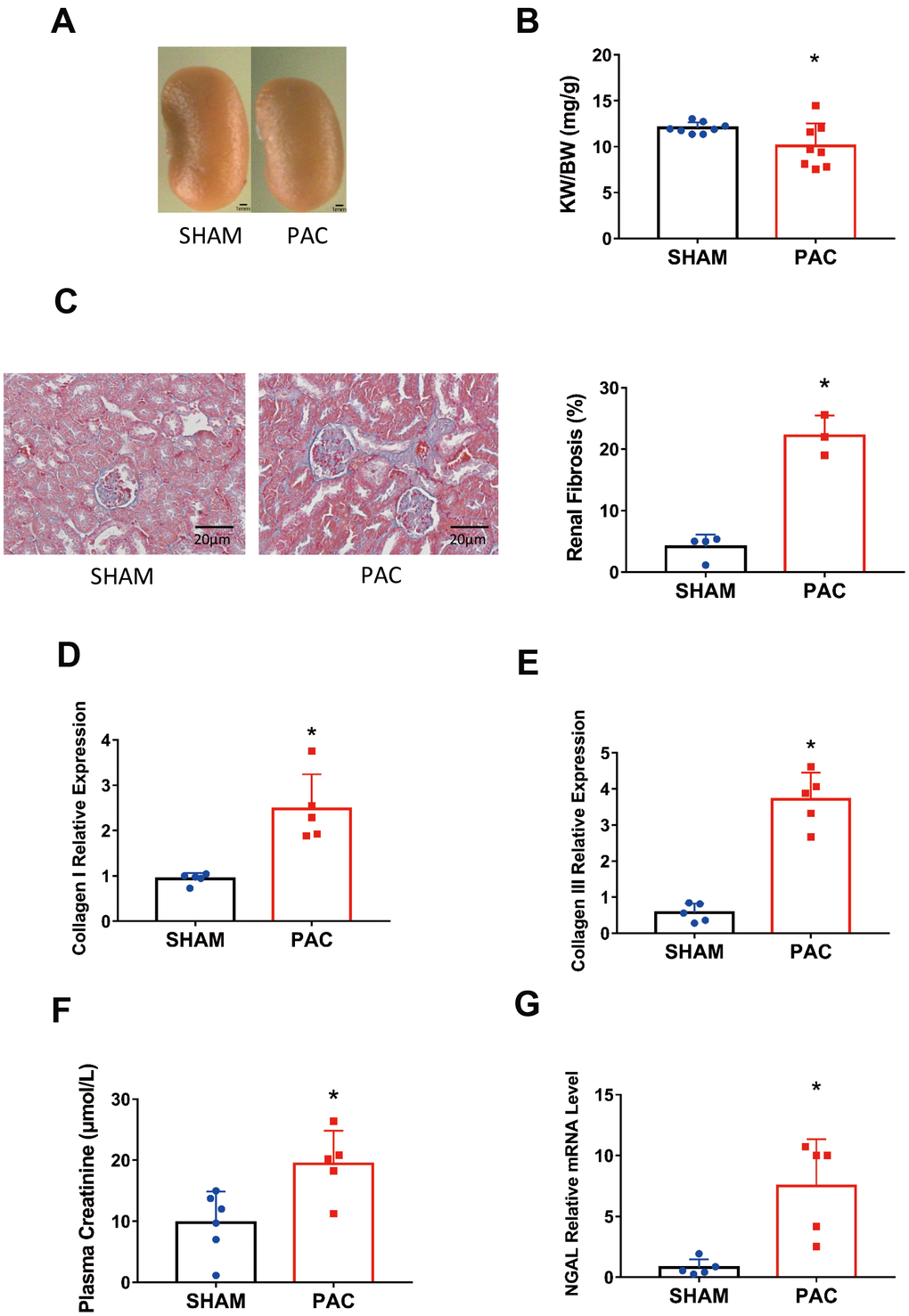 Pulmonary artery constriction induced renal dysfunction. (A) Representative pictures of the kidney in the sham and PAC groups. (B) The kidney weight to body weight ratio (KW/BW). (C) HE staining of the section around the glomerulus and their corresponding fibrosis area percentage. (D, E) Gene expression level of collagen I and collagen III in the kidney. (F) Plasma creatinine concentration in the two groups. (G) Gene expression level of neutrophil gelatinase-associated lipocalin (NGAL). PAC: Pulmonary artery constriction. *P C.