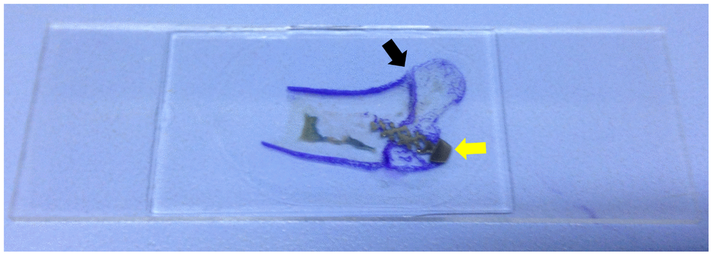 Slice specimen of the bone in-growth. The dyed area (purple, black arrow) is the greater tuberosity of proximal humerus. The grey area is the screw (yellow arrow).