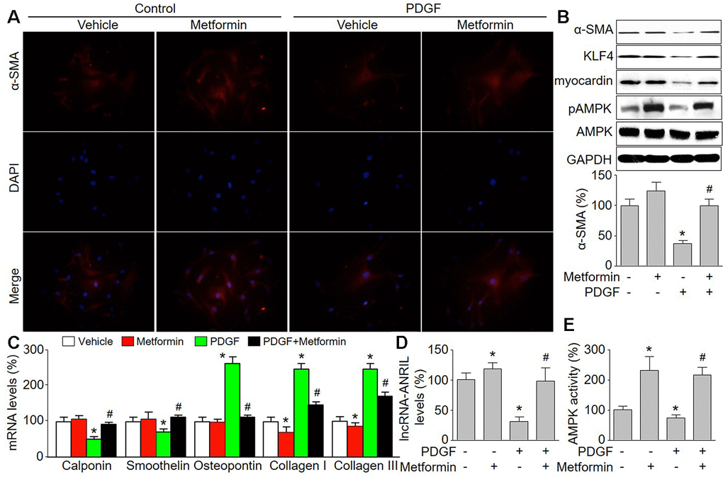 Metformin inhibits PDGF-induced phenotypic switching and increases the expressions of lncRNA-ANRIL in cultured VSMCs. Cultured VSMCs were treated with PDGF (5 ng/ml) for 48 hours in presence or absence of metformin (1 mM). (A) The morphology of contractile phenotype in cells was determined by immunofluorescence analysis of alpha SMA (α-SMA). (B) Total cell lysates were subjected to perform western blot analysis of phosphorylated AMPK (pAMPK), total AMPK protein levels, α-SMA, KLF4, and myocardin. (C) The mRNA levels of the phenotypic switching markers, including calponin, smoothelin, osteopontin, collagen I, and collagen III were measured by real-time PCR. (D) The lncRNA-ANRIL level was assessed by real-time PCR. (E) AMPK activity was assayed by P32-ATP method. N is 5 in each group. *P#P