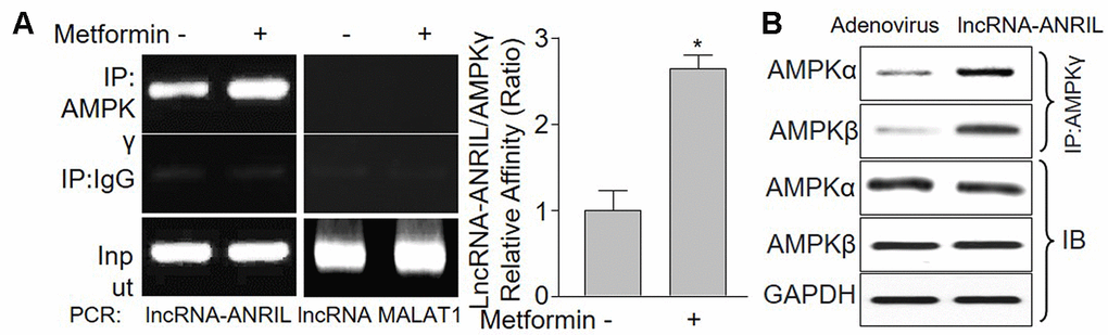 LncRNA-ANRIL regulates AMPK catalytic activity by binding to AMPK gamma subunit. (A) Cultured VSMCs were incubated with metformin (1 mM) for 12 hours. Cells were subjected to detect the binding of lncRNA-ANRIL or lncRNA-MALAT1 to AMPKγ subunit by using RNA-immunoprecipitation assay in (A) Quantitative analysis of the affinity between lncRNA-ANRIL and AMPKγ was performed. N is 5 in each group. *PB) Cultured VSMCs were infected with adenovirus expressing lncRNA-ANRIL for 48 hours. The binding of AMPKα or β to AMPKγ was assayed by IP.