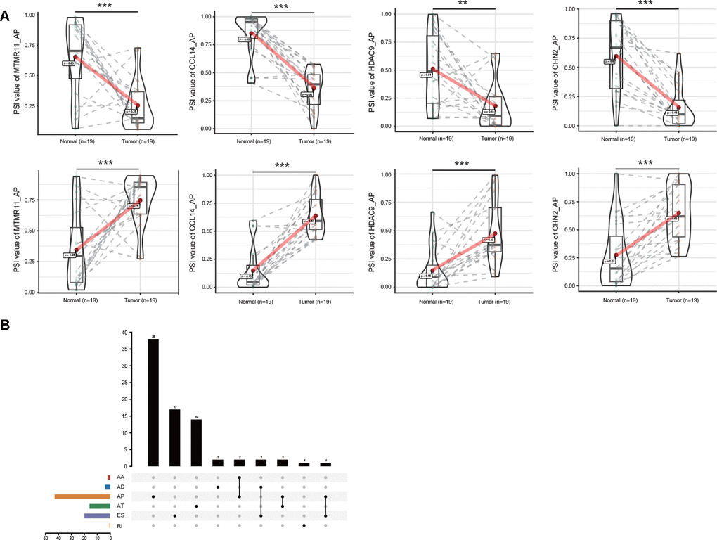 Profiling of DEAS EVs identified in GC. (A) The opposite trend of representative DEGs between GC and adjacent normal tissues is shown in violin plots. Some AS events of these representative DEGs were upregulated in GC tissues (upper). The same AS events of these representative DEGs were downregulated in GC tissues for the different splicing sites (lower). (B) Interactive analysis of DEGs between GC and adjacent normal tissues is shown in an UpSet plot.