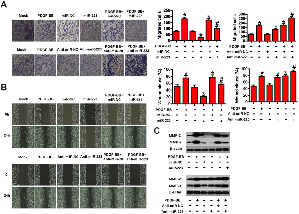MiR-223 inhibited the migration of PDGF-stimulated HASMCs. Serum-deprived HASMCs were transfected with miR-223, miR-NC, and anti-miR-223 or anti-miR-NC for 24 h, followed by PDGF-BB stimulation for 24 h. (A) Transwell assay was conducted to assess cell migration. (B) The migratory ability of HASMCs was evaluated by wound healing assay. (C) Western blot assay was conducted to analyze the expressions of MMP-2 and MMP-9. β-actin was used as the endogenous control. The data are shown as mean ± SD of three separate experiments. *P #P 
