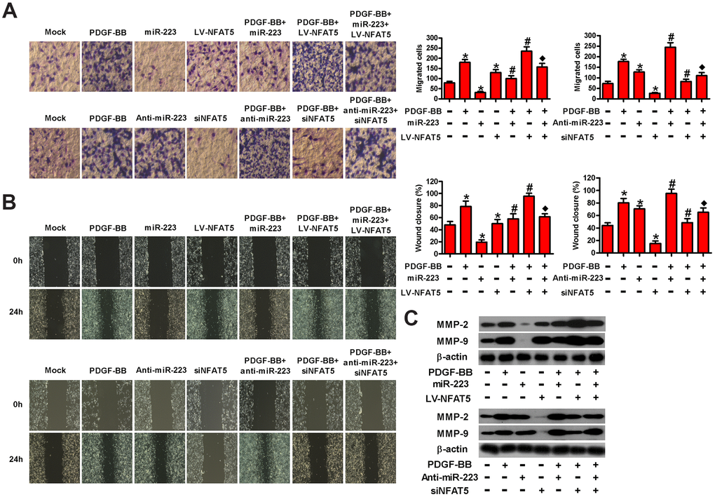 MiR-223 repressed the migration of PDGF-BB-exposed HASMCs by targeting NFAT5. Serum-deprived HASMCs were co-treated with miR-223 and LV-NFAT5 or anti-miR-223 and siNFAT5 for 24 h, followed by PDGF-BB stimulation for 24 h. (A) Transwell and (B) wound healing assays were conducted to measure cell migration. (C) The expression of MMP-2 and MMP-9 was detected by Western blot assays. β-actin was used as the endogenous control. The data are shown as mean ± SD of three separate experiments. *P #P ♦P 