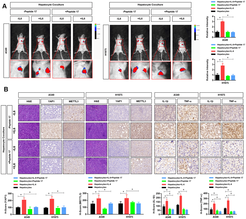 YAP1 blockade significantly inhibited the effects of the hepatic inflammatory microenvironment on the metastasis of lung adenocarcinoma (LUAD) cells. (A) Forty mice were divided into 8 groups, with 5 mice in each group. Cell grouping was similar to that of in vitro experiments, which were stimulated by the hepatic immune microenvironment and/or treated with the YAP1 inhibitor peptide 17 for 24 hours. After these treatments, 5×106 cells each mouse was injected by tail vein and bioluminescence imaging (BLI) was performed 25 days later using the NightOWL II LB 983 imaging system (Berthold). (B) At the end of the experiment, all animals were sacrificed under anesthesia, and the metastasis tumors were fixated by Formalin and used for HE or IHC staining of YAP1 (×200), METTL3 (×200), IL-1b (×300) and TNF-a (×300). The quantitative analysis of IHC were performed by H-score scoring (*P