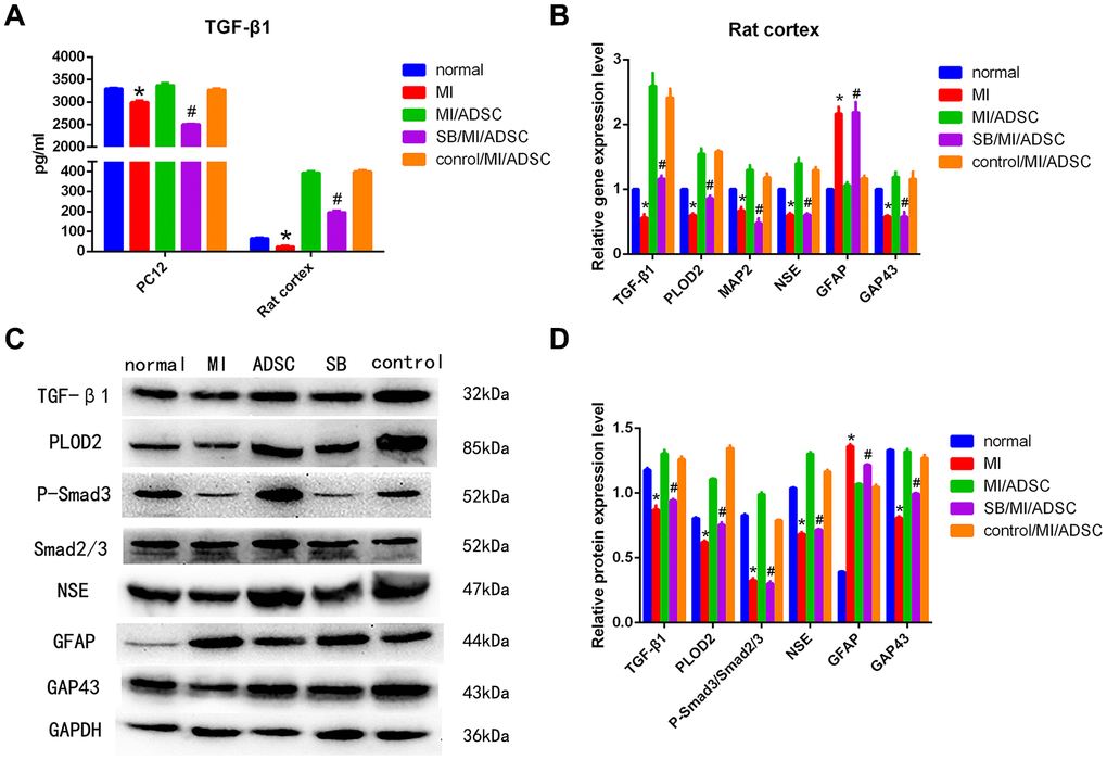 ADSCs protect neurons from MI by activating the TGF-β1/Smad3 signaling pathway. (A) Analysis of TGF-β1 secretion in culture supernatants from cells subjected to MI and treated with SB431542 (SB). (B) Detection of TGF-β1, PLOD2, MAP2, NSE, GFAP, and GAP43 mRNA levels by qRT-PCR. (C, D) Western blot analysis of TGF-β1, PLOD2, P-Smad3, Smad2/3, and neuronal/glial markers in rat cortical neurons. Results presented as mean ± SD and evaluated with one-way ANOVA. *PP