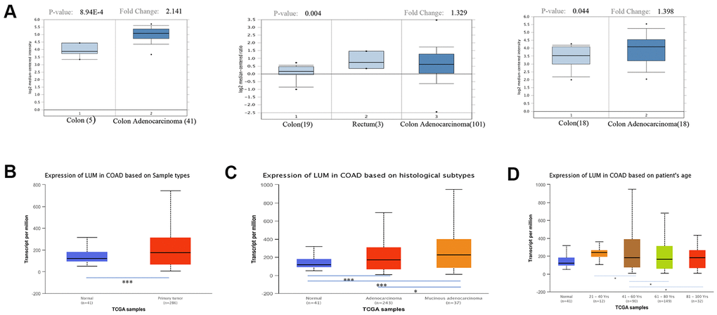 Expression of LUM in cancer and paracancerous tissues of COAD in the Oncomine and UALCAN databases. (A) mRNA expression of LUM in cancer tissues and paracancerous tissues in different microchips from the Oncomine database. Expression of LUM in (B) cancerous and paracancerous tissues, (C) cancer subtypes, and (D) by patient age. *P 