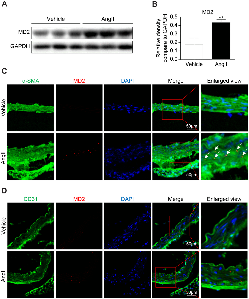 MD2 is increased in aortas of Ang II induced mice. (A) MD2 protein levels in aortas of mice induced by Ang II were detected by western blotting. Panel (B) showed densitometric quantification (n = 10; **PC) Representative immunofluorescence staining of MD2 (red) and VSMCs marker α-SMA (green). Tissues were counterstained with DAPI (blue). Yellow arrows indicate co-location of MD2 and α-SMA stanning (scale bar = 50 μm). (D) Representative immunofluorescence staining of MD2 (red) and endothelial cells marker CD31 (green). Tissues were counterstained with DAPI (blue). Yellow arrows indicate co-location of MD2 and CD31 stanning (scale bar = 50 μm).