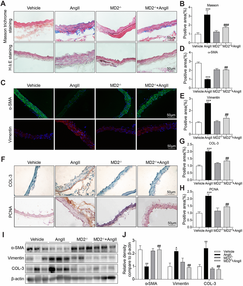 MD2 deficiency alleviated Ang II induced vascular remodeling in vivo. (A) Aortic thickening in the mice and aortic tunica media fibrosis was examined by Masson trichrome staining and H&E staining (scale bar = 50 μm). (B) Quantification for staining results in 2A (n = 10; ***pC) Representative immunofluorescence staining images for α-SMA (green) and Vimentin (red) in aortas. Tissues were counterstained with DAPI (blue) (scale bar = 50 μm). (D, E) Quantification for staining results in 2C (n = 10; ***pF) Representative images of COL-3 and PCNA staining of aortas (scale bar = 500 μm; DAB chromogen staining (brown). (G, H) Quantification for staining results in 2F (n = 10; ***pI, J) Expressions of α-SMA, Vimentin and COL-3 in the whole aorta (n = 10; *p