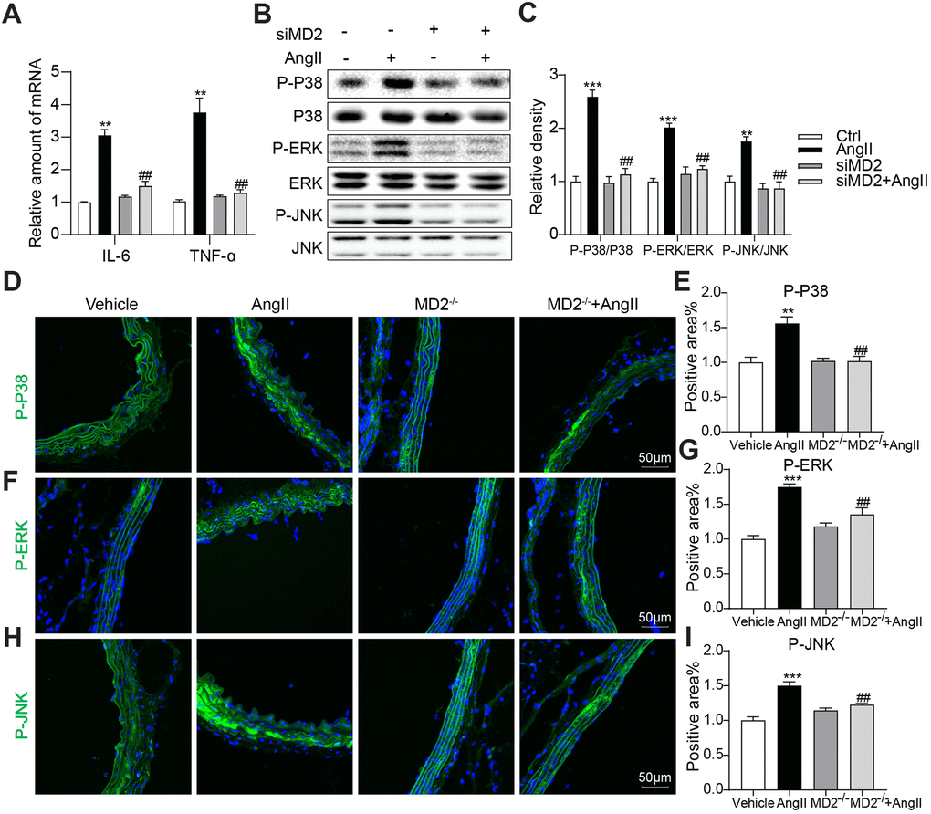 MD2 knockdown reduced Ang II-induced inflammation by inhibition of MAPKs phosphorylation. VSMCs were transfected with siRNA against MD2 for 6 h and then incubated with Ang II for 6 h (panel A) and 30 min (panel B, C). (A) The level of TNF-α and IL-6 were detected using real-time qPCR assay (n = 3; **pB, C) Expressions of P-ERK, P-JNK, P-P38 in the cultural medium were detected by western blot (n = 3; **pD–I) Representative immunofluorescence staining images and quantification results for P-ERK (green), P-JNK (green), P-P38 (green) in mouse aortas. Tissues were counterstained with DAPI (blue) (scale bar = 50 μm) (n = 10; **p