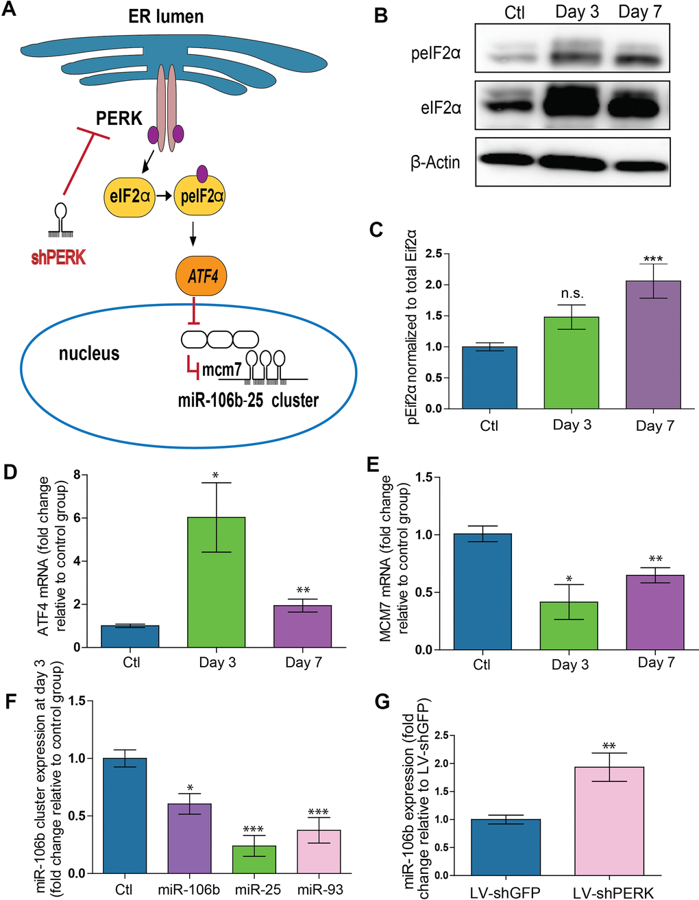 PERK activation provokes downregulation of miR-106b-25 cluster and MCM7 host gene in a mouse model of CNV. (A) Schematic of ER stress activation of PERK pathway. (B) Western blot of Phospho-EIF2α, total-EIF2α and β-actin in control choroids, and 3 and 7 days after burns. (C) Western blot quantification in control choroids, 3 days (n=7) and 7 days after burns (n=6). (D) Aft4 mRNA expression in control choroids, 3 days (n=6) and 7 days after burns (n=10). (E) Mcm7 mRNA expression in control choroids, 3 days (n=6) and 7 days after laser burn (n=14). (F) miR106~25 cluster member expression in choroids 3 days after laser burn (miR-106b (n=7), miR-25 (n=6) and miR-93 (n=5). (G) miR-106b expression after infection of HRMECs with LV.shGFP (negative control), and LV.shPERK (n=5). Data are expressed as mean ± S.E.M. One-way ANOVA with Bonferroni post-hoc test was performed on groups of 3 or more, and unpaired Two-tailed Student’s t-test was used for the analysis of groups of 2, *P 