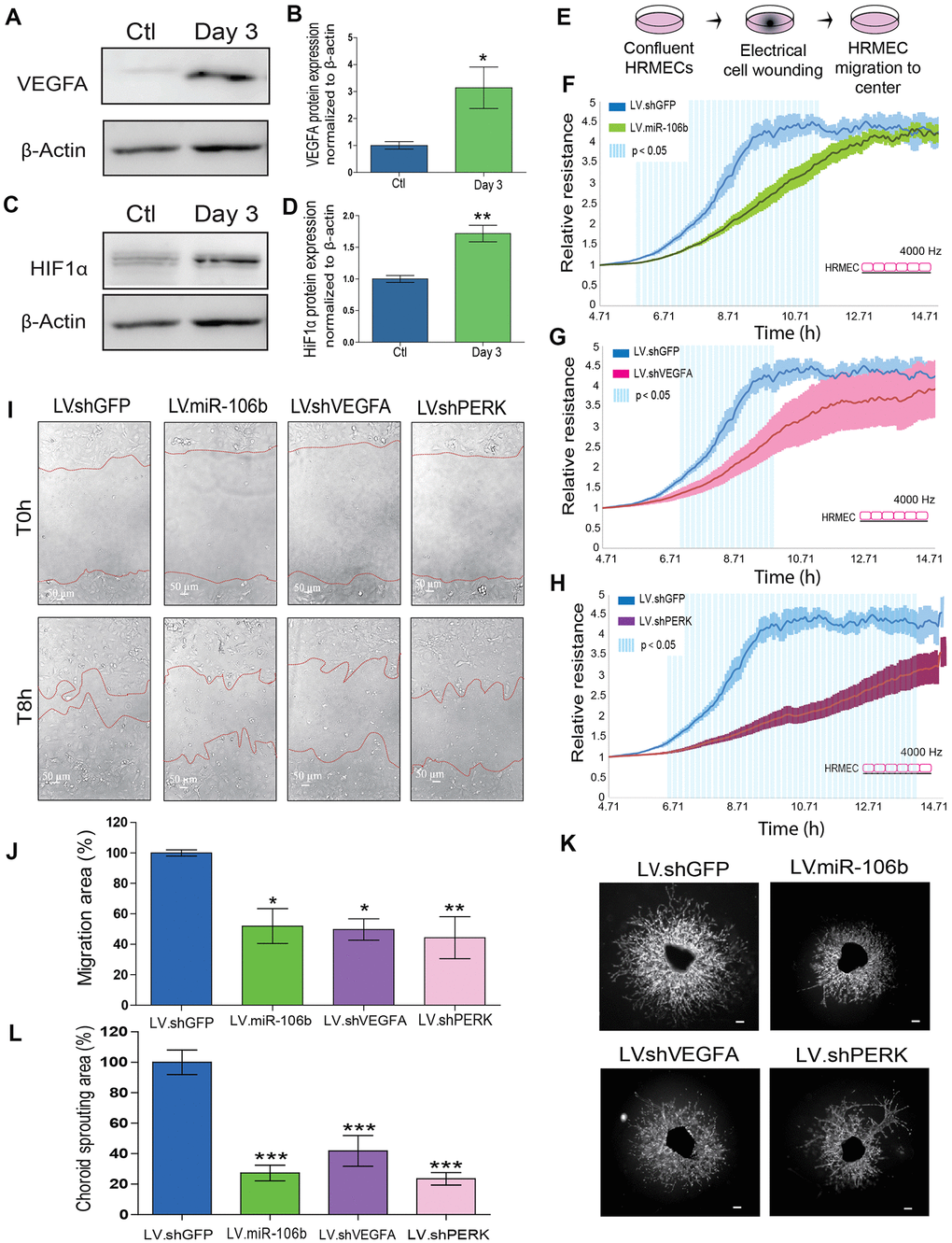 miR-106b exerts an anti-angiogenic effect and impairs retinal endothelial cell migration. (A) Western blot of VEGFA and β-actin from control choroids and 3 days after burns, and (B) quantification (n=4). (C) Western blot of HIF1α and β-actin from control choroids and 3 days after burns, and (D) quantification (n=4). (E) Schematic of ECIS cell migration assay procedure. HRMEC ECIS with (F) LV.miR-106b (n=4), (G) LV.shVEGFA (n=4) and (H) LV.shPERK (n=4) compared to LV.shGFP control. (I) HRMEC scratch assay infected 72h with LV.shGFP, LV.miR-106b, LV.shVEGFA and LV.shPERK at T0h and after 8h. (J) Migration area quantification of scratch assay with LV.miR-106b (n=4), LV.shVEGFA (n=4), and LV.shPERK (n=4) compared to LV.shGFP. (K) Sprouting assay with choroid explants infected with LV.shGFP, LV.miR-106b, LV.shVEGFA, and LV.shPERK. (L) Sprouting area quantification with LV.miR-106b (n=9), LV.shVEGFA (n=9), LV.shPERK (n=8) compared to LV.shGFP control. Scale bar = 500 μm. Data are expressed as mean ± S.E.M. Unpaired Two-tailed Student’s t-test was used for the analysis of groups of 2, and one-way ANOVA with Bonferroni post-hoc test was performed on groups of 3 or more, *P 