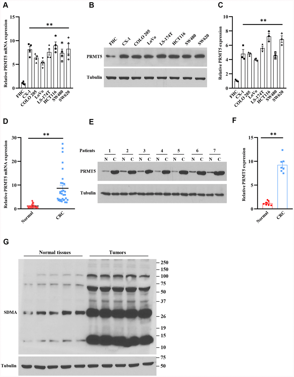 PRMT5 is highly expressed in human colorectal cancer cells and tissues. (A) The mRNA expression level of PRMT5 in various human colorectal tumor cell lines and normal colonic mucosal FHC cells (n=4). **P B) Western blot analysis of PRMT5 protein expression level in various human colorectal tumor cell lines and normal colonic mucosal FHC cells. Representative data is shown. (C) PRMT5 protein expression level is quantified. **P D) qRT-PCR analysis of PRMT5 mRNA expression level in human colorectal cancer tissues and adjacent normal tissues (n=25-30). **P E) PRMT5 protein expression level is analyzed by Western blotting in human colorectal cancer tissues and adjacent normal tissues (n=7). Representative data is shown. (F) PRMT5 protein expression level is quantified. **P G) The global symmetric dimethylarginine (SDMA) is detected by Western blotting. Representative data is shown.