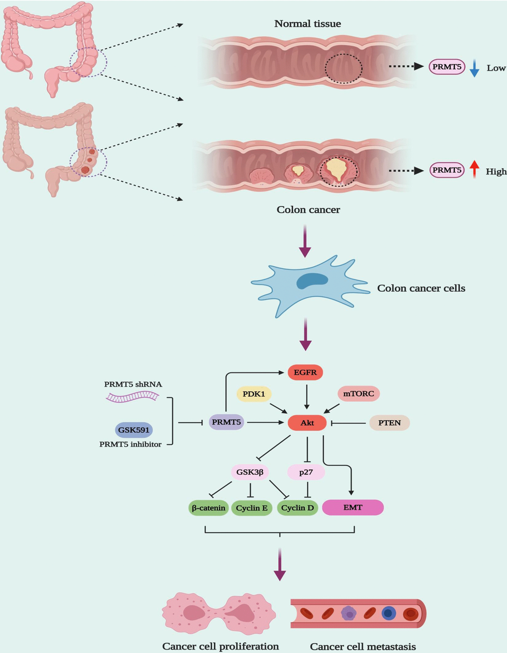 The model of PRMT5 regulation of human colorectal cancer cell growth and EMT.