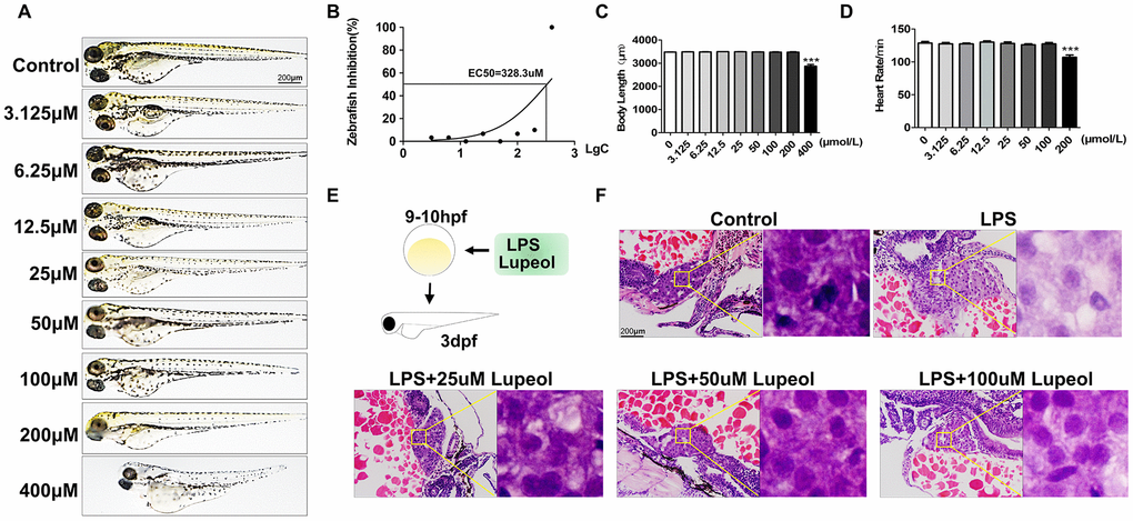 Lupeol attenuates liver injury induced by LPS in zebrafish. (A–D) Zebrafish larvae were treated with different concentrations of lupeol (0, 3.125, 6.25,12.5,25,50,100,200, and 400μmol) to observe changes in zebrafish morphology, survival rate, body length and heart rate. N=20, data are expressed as the mean ± SEM, *PE) Schematic diagram of treatment on zebrafish. (F) H&E staining of the liver in zebrafish larva. Magnification, 400×, bar=200μm.
