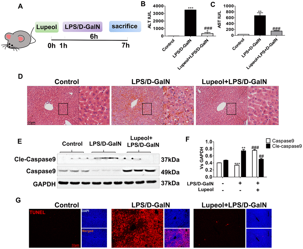 Lupeol alleviates LPS/GalN-induced liver injury in mice. (A) Diagrammatic sketch mice modeling and lupeol administration. (B, C) Changes in serum ALT and AST. (D) H&E staining was used to detect the liver histopathological changes. (E, F) Expression of caspase 9 and cleaved-caspase 9 protein in mice. (G) TUNEL staining of paraffin liver sections in control mice and mice treated with LPS/GalN or lupeol. Data are expressed as the mean ± SEM, n=3-6 per group, *P