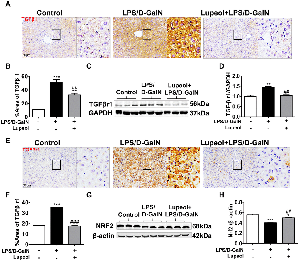 Lupeol downregulates TGFβr1 and upregulates Nrf2 pathway in mice with ALI. (A, B) Immunohistochemistry staining and quantitative analysis of TGFβ1. (C) Western blot analysis for the expressions of TGFβr1. (D) Quantitative analysis of TGFβr1 protein. (E, F) Immunohistochemistry analysis and quantification for detecting the expressions of TGFβr1. (G, H) Western blots and quantitative results for Nrf2. All data are shown as the mean ± SEM, n=3-4 group, *P