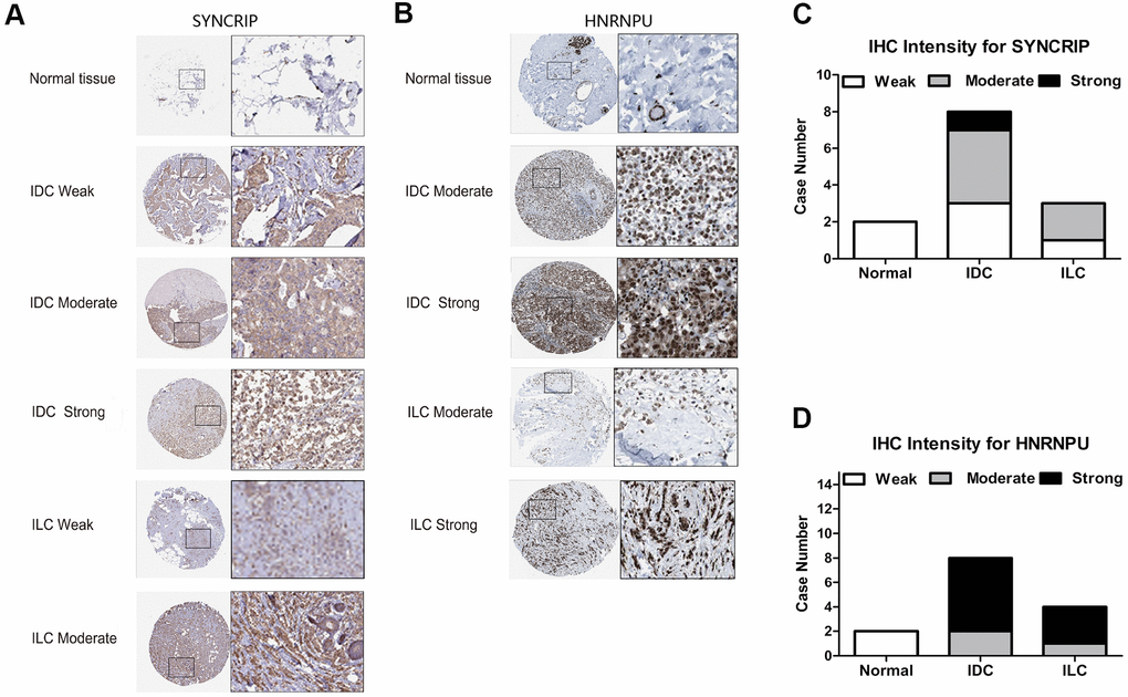 The IHC expression pattern of SYNCRIP and HNRNPU in normal breast tissues and BRCA. (A, B) Representative images are shown for strong, moderate, weak and negative expression of SYNCRIP and HNRNPU in normal breast tissues and BRCA (IDC and ILC). The black rectangle indicates a higher magnification of the indicated area in the image. (C) Bar chart of the IHC staining intensity of SYNCRIP for BRCA (a total of 13 cases). (D) Bar chart of the IHC staining intensity of hnRNPU for BRCA (a total of 14 cases).