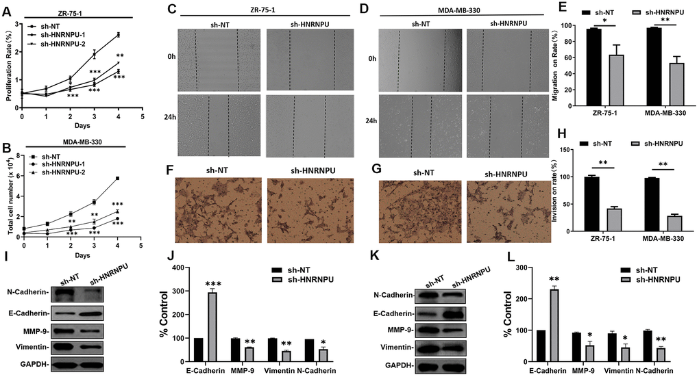 HNRNPU improved metastatic ability of cells by activating EMT phenotypes in BRCA cells. (A, B) Effects of HNRNPU knockdown on the proliferation of ZR-75-1 and MDA-MB-330 cells. (C–E) Representative images from the Transwell migration assays for ZR-75-1 and MDA-MB-330 cells transfected with sh-HNRNPU and sh-NT. (F–H) Representative images from the wound-healing assays for ZR-75-1 and MDA-MB-330 cells transfected with sh-HNRNPU and sh-NT. (I–L) Effects of HNRNPU knockdown on the expression of EMT signal protein detection in ZR-75-1 (I, J) and MDA-MB-330 (K, L) cells using western blotting. *P P P 