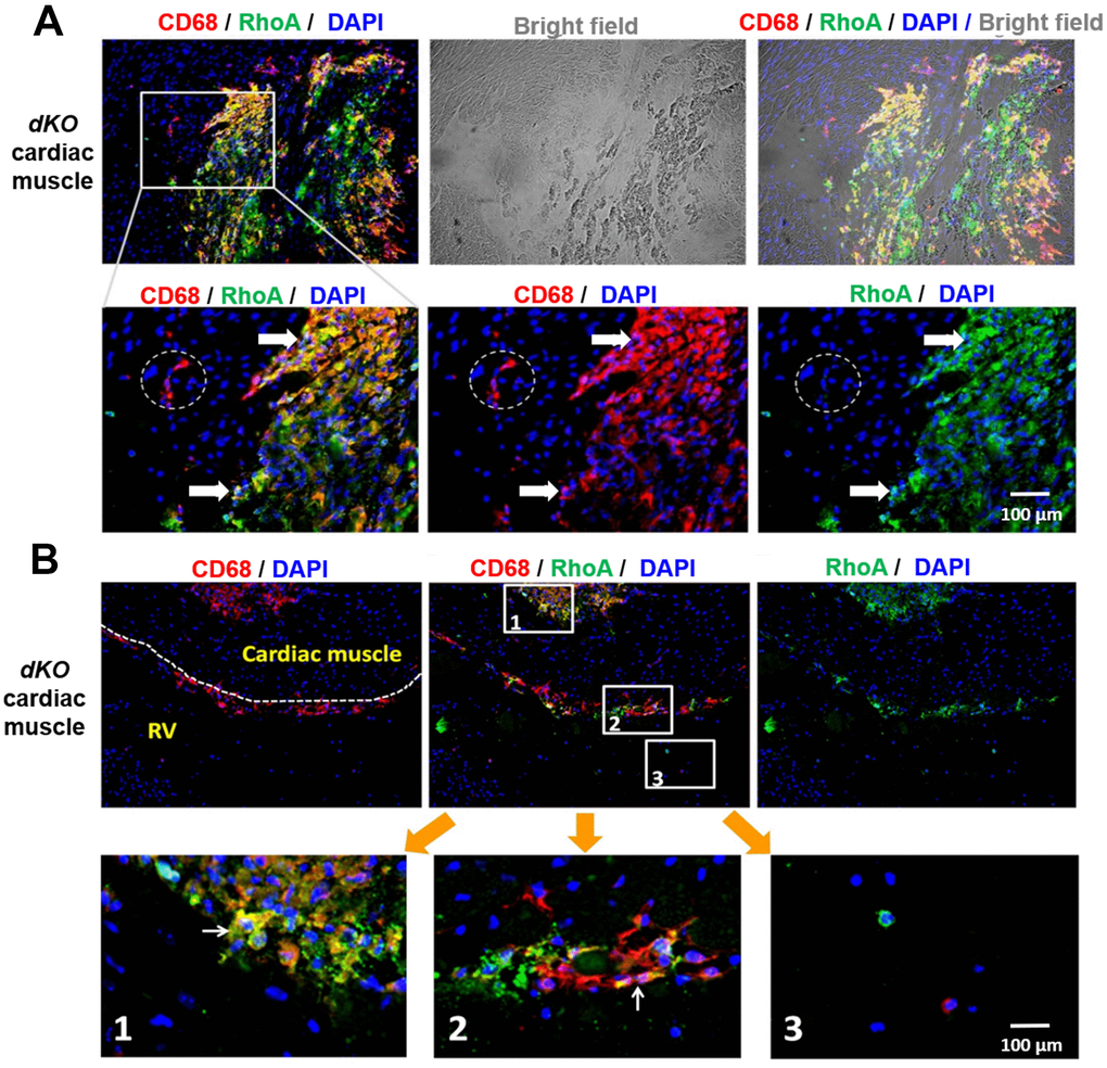 CD68+ cells at calcification sites in the heart of dKO mice co-express RhoA. (A) Immunostaining of dKO heart sections (cardiac muscle at septum) with RhoA and CD68 antibodies showing that many of the accumulated CD68+ cells at the sites of ectopic calcification are RhoA+ (white arrows); whereas the CD68+ cells away from the calcification sites are RhoA- (dotted circle). (B) Immunostaining of dKO heart sections (interface of right ventricle and septum) with RhoA and CD68 antibodies showing accumulation of RhoA+/CD68+ cells at the endothelial barrier (cardiac endothelium, dotted lines) which are infiltrating through the endothelium from circulation towards the pathological area of the cardiac muscle (sub-image 2); whereas the CD68+ cells in the circulating blood are RhoA- (sub-image 3). N=6 for both WT and dKO mice (8-week old).