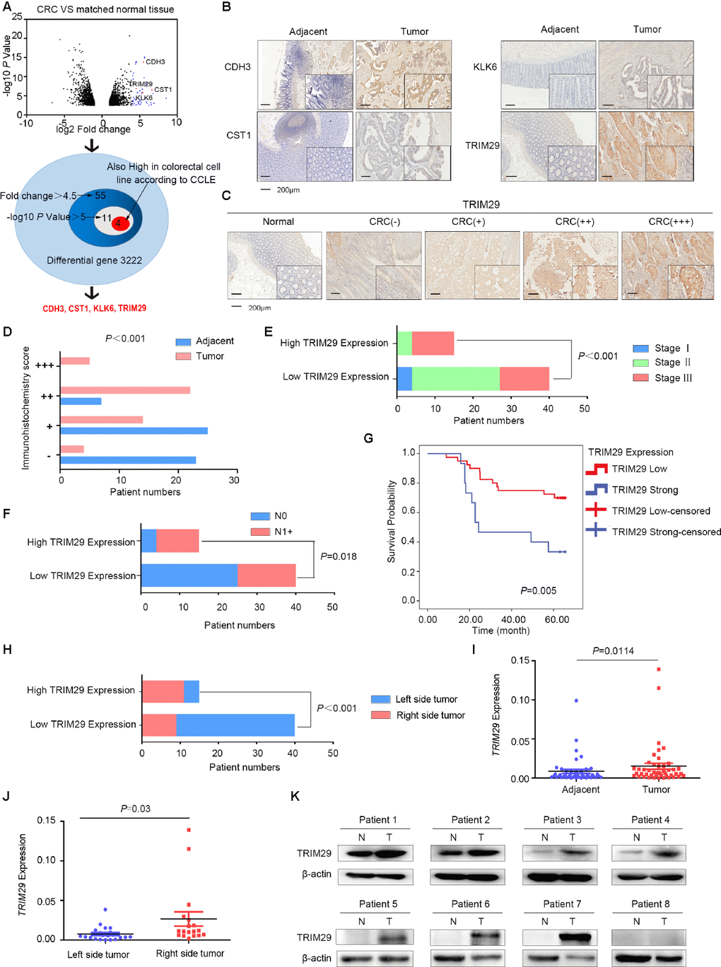 TRIM29 is upregulated in colorectal cancer. (A) The expression of CDH3, CST1, KLK6 and TRIM29 is upregulated in colorectal cancer (CRC) tissues and cell lines. (B) Immunohistochemistry (IHC) results showed that CDH3, CST1, KLK6 and TRIM29 expression was upregulated in CRC. (C) Representative IHC images of TRIM29 expression. (D) Statistical data graph of patients with different TRIM29 expression levels in CRC tissues and noncancerous samples (PE) Statistical data graph of patients with or without lymph node metastasis stratified by TRIM29 expression level (P=0.018). (F) Statistical data graph of patients at different stages stratified by TRIM29 expression level (PG) Kaplan-Meier curves for CRC patients according to TRIM29 expression levels. The statistical analysis was performed using the chi-square test (P=0.005). (H) IHC results showed that TRIM29 is expressed at much higher levels in RSCC than in LSCC (PI) qPCR was used to measure the relative expression levels of TRIM29 in CRC samples and their matched noncancerous samples (PJ) The qPCR results showed that TRIM29 is expressed at much higher levels in RSCC than in LSCC (PK) Western blotting was used to detect TRIM29 expression in 8 pairs of samples. The statistical analysis was performed using the chi-square test (D–F, H) and two-tailed Student’s t-test (I, J). The error bars represent the SEM. Kaplan-Meier method compared with a log-rank test. *P P P P 