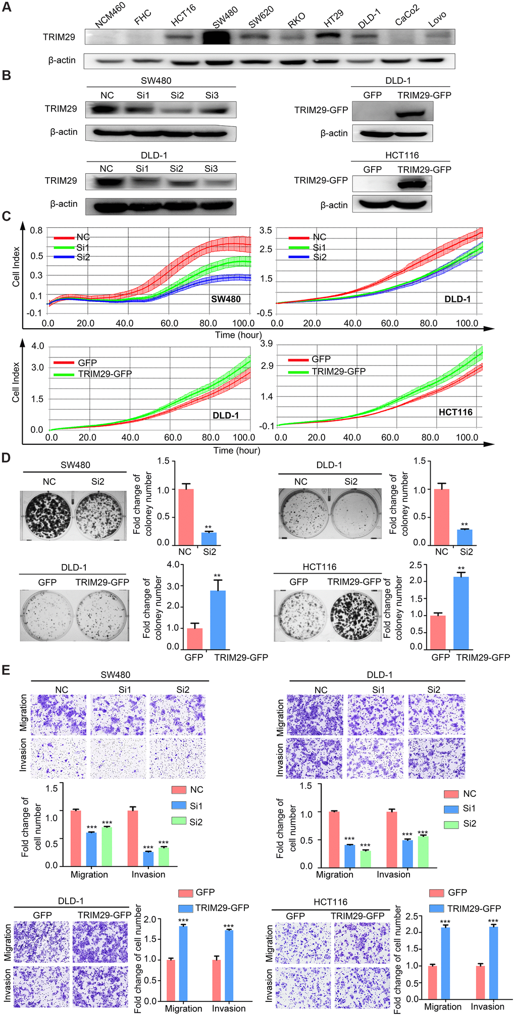 TRIM29 promotes the malignant phenotype of CRC in vitro. (A) Western blotting was used to analyze the level of TRIM29 in CRC cell lines. (B) The efficiency of TRIM29 knockdown using siRNA in SW480 and DLD-1 cells and TRIM29 overexpression in DLD-1 and HCT116 cells. (C–E) SW480 and DLD-1 cells were transfected with siRNA, while HCT116 and DLD-1 cells were transfected with the TRIM29 overexpression plasmid. (C) After transfection for 24 h, an RTCA-MP proliferation assay was performed to measure cell proliferation. (D) Colony formation assay. (E) Transwell assays were performed to measure cell migration and invasion. The error bars represent the SEM. The statistical analysis was performed using two-tailed Student’s t-test. **P P P 