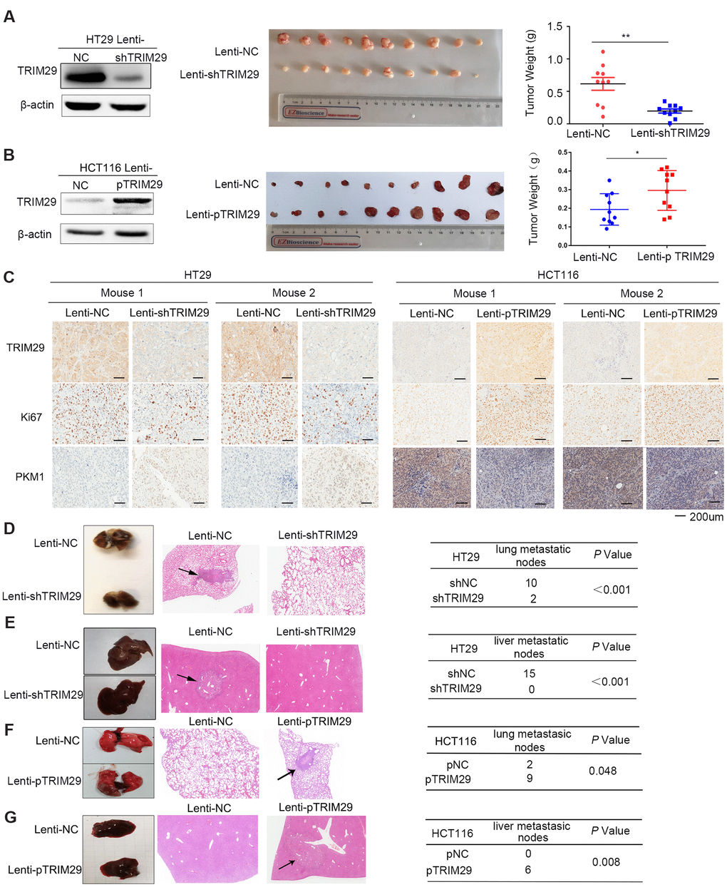 TRIM29 promotes the growth and metastasis of CRC in vivo. (A, B) Mice were subcutaneously injected with HT29 cells (A) or HCT116 cells (B) in both side of the top back (lenti-NC in the left and lenti-shTRIM29/lenti-pTRIM29 in the right). Tumor weight of both lenti-NC and lenti-shTRIM29/lenti-pTRIM29 cell-derived tumors in nude mice was measured two weeks later (n=10). (C) Representative IHC staining of TRIM29, Ki67 and PKM1 in two mice with HT29 and HCT116 xenografts derived from lenti-NC and lenti-shTRIM29/lenti-pTRIM29 cells. (D–G) Mice were injected with HT29 or HCT116 cells (2*106 cells in 0.1 ml) via tail vein; lenti-NC group (n=5), lenti-shTRIM29/lenti-pTRIM29 group (n=5). (D, F) Rate of lung metastasis after tail injection. (E, G) Rate of liver metastasis after tail injection. The statistical analysis was performed using two-tailed Student’s t-test. *P P P 