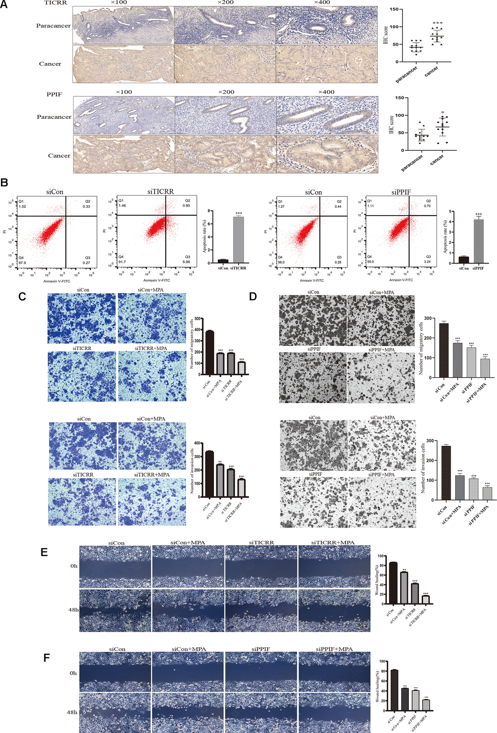 IHC staining and functional verification of TICRR and PPIF genes. (A), The expression of TICRR and PPIF in endometrial cancer and paracancer samples were assessed using IHC staining and the results of statistical analysis. (B) Analysis of apoptosis by Flow cytometry after transfection with siTICRR and siPPIF respectively. (C) Hec-1B-siTICRR cells were subjected to migration and invasion assays in the presence or absence of MPA. (D) Migration and invasion ability of siPPIF transfected cells in the presence or absence of MPA. (E) Wound-healing assays for Hec-1B-siTICRR cells. (F) Wound-healing assays for Hec-1B-siPPIF cells. Data were shown as mean ± SD; *p 