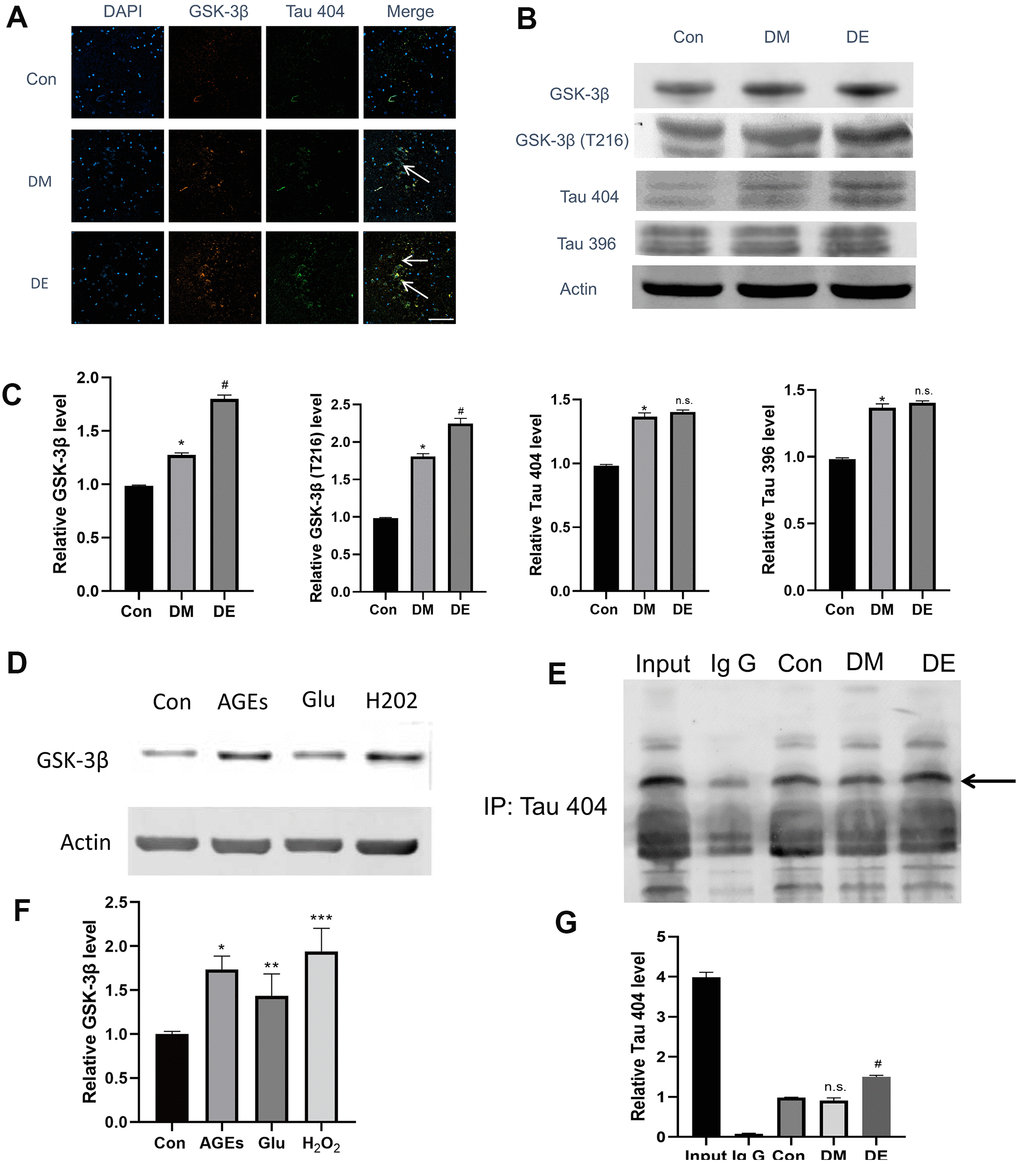 High expression of GSK-3β and Tau404 in injured HT-22 cells and diabetic hippocampal tissues. (A) Immunostaining analysis showing the enhanced colocalized relationship in Con, DM, and DE groups, progressively (as evidenced by overplay yellow areas in Merge image). Also, GSK-3β and Tau 404 Con are highly expressed in DM, and DE groups, progressively. (B, C) The immunoblot suggesting a high expression of GSK-3β, GSK-3β(T216), and Tau 404 in Con, DM, and DE groups, progressively. However, the expression levels of Tau 396 and Tau 404 are not different between DM and DE groups. (D, F) In vitro experiment (mimicking) which demonstrates higher expression levels of GSK-3β in Glu, AGEs, and H2O2 groups, vs Con in HT-22 cells. (E, G) The IP analysis demonstrating a binding relationship between GSK-3β and Tau 404, and this relationship is enhanced in DM and DE groups. *P #P P 