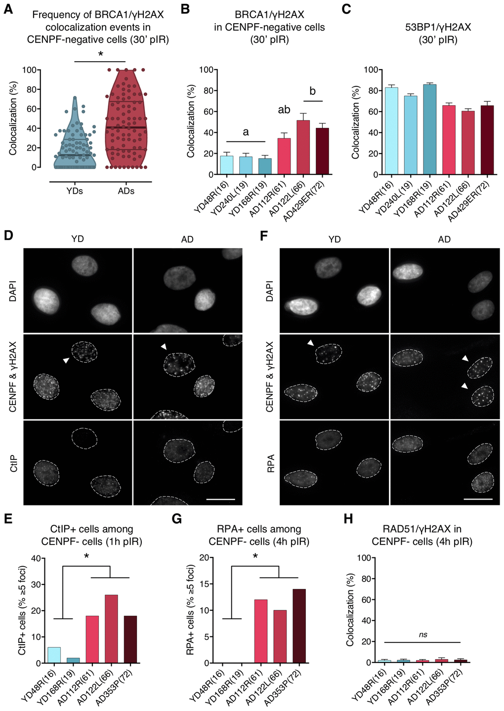 BRCA1, CtIP and RPA but no RAD51 are ectopically recruited to DNA DSBs in G1 cells from aged donors. (A) Percentage of BRCA1/γH2AX foci colocalization in CENPF-negative cells at 30 min after irradiation for each age group. Each dot corresponds to the fraction of BRCA1 and γH2AX foci colocalizing within one pore and the mean and quartiles are indicated (* p n is stated in Supplementary Table 4; Mann–Whitney test). (B) Summary values for individual donors. Error bars indicate SEM (a≠b p n is stated in Supplementary Table 4; Kruskal–Wallis + Dunn). (C) Percentage of 53BP1/γH2AX foci colocalization for individual donors at 30 min after irradiation. Error bars indicate SEM (n is stated in Supplementary Table 2). (D) Immunofluorescent labeling of cell nuclei (DAPI), CENPF (A532), γH2AX (A594) and CtIP (A488). Arrowheads indicate G1 (CENPF-negative) cells. Scale bar = 20 μm. (E) Frequency of CtIP-positive HMECs (≥ 5 foci) at 1 h after irradiation (5 Gy, γ-rays). Analysis was restricted to CENPF-negative cells (* p n ≥ 50 cells/donor; Fisher’s exact test). (F) Immunofluorescent labeling of cell nuclei (DAPI), CENPF (A532), γH2AX (A594) and RPA (A488). Arrowheads indicate G1 (CENPF-negative) cells. Scale bar = 20 μm. (G) Frequency of RPA-positive HMECs (≥ 5 foci) at 4 h after irradiation (5 Gy, γ-rays). Analysis was restricted to CENPF-negative cells (* p n ≥ 50 cells/donor; Fisher’s exact test). (H) Percentage of RAD51/γH2AX foci colocalization in CENPF-negative cells at 4 h after irradiation (5 Gy, γ-rays). Error bars indicate SEM (nsp > .05; n ≥ 1000 γH2AX foci/donor; Kruskal–Wallis + Dunn).