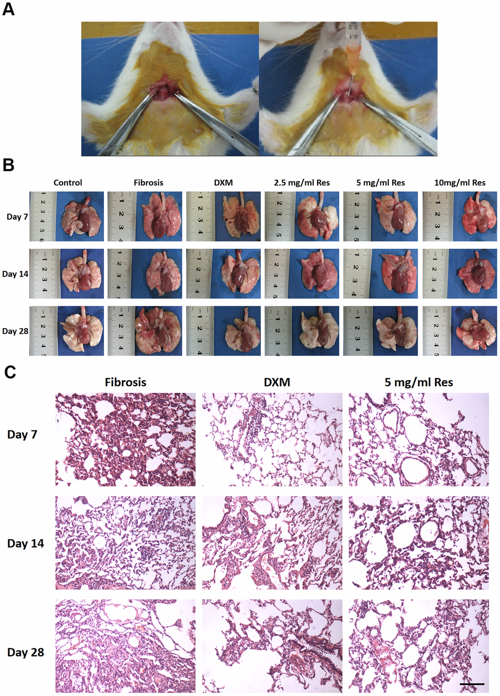 Resveratrol reverses bleomycin-induced pulmonary fibrosis in vivo. (A) Administration of resveratrol to establish bleomycin-induced pulmonary fibrosis model in rat. (B) Gross views of the lungs on days 7, 14, and 28 following different treatments. Data are expressed as mean ± standard deviation (SD) of three independent experiments. *p p p p C) The results of hematoxylin and eosin (H&E) staining of samples obtained from the lungs on days 7, 14, and 28 following different treatments (scale bar = 200 μm).