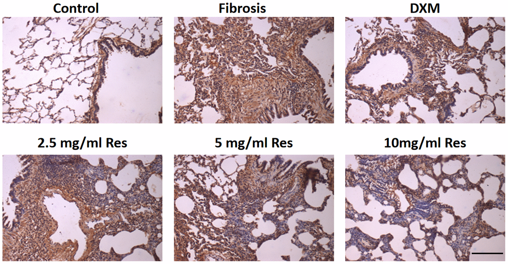 Increased expression of NF-κB in the rat fibrosis model was detected via IHC. The expression of NF-κB was measured by immunohistochemistry in the six groups following different treatments. Scale bar = 200 μm.