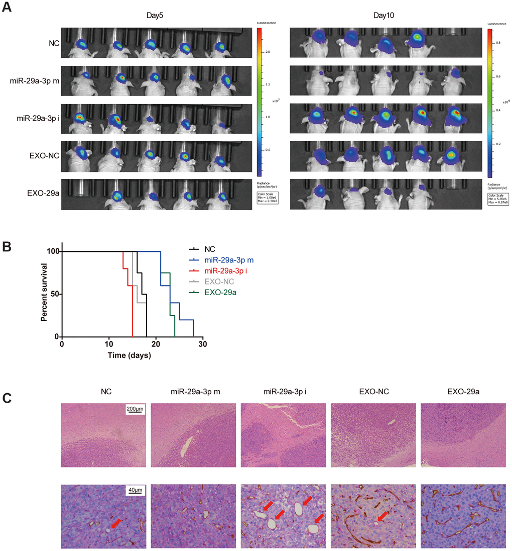 Effects of exosomes overexpressing miR-29a-3p resembled the anti-glioma effects of miR-29a-3p overexpression in vivo. (A) Bioluminescence imaging showed the tumour sizes on day 5 and day 10 after transplantation. (B) Kaplan–Meier survival curves for animals in different groups (miR-29a-3p m VS NC, p=0.0040; miR-29a-3p i VS NC, p=0.0074; EXO-29a VS NC, p=0.0091; EXO-29a VS EXO-NC, p=0.0060; EXO-NC VS NC, p=0.5433; log-rank test; n=23). (C) Representative images of the tumour/brain border with HE staining (upper panels; scale bar, 200 μm) and CD34-PAS IHC staining of VM structures (lower panels, red arrows; scale bar, 40 μm).