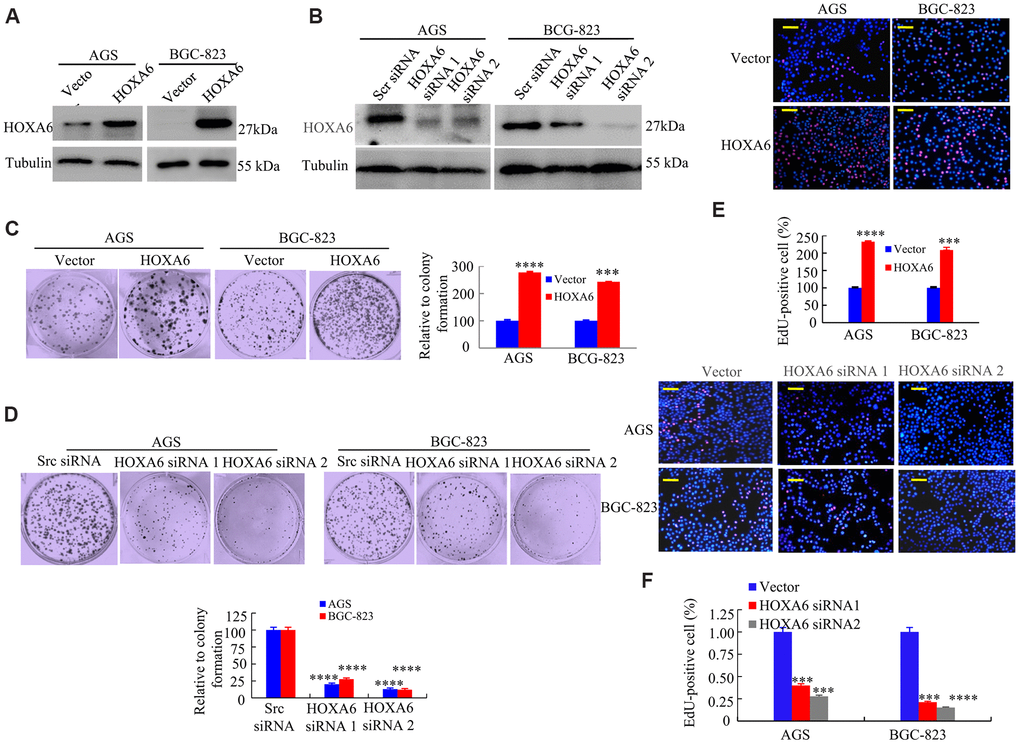 The effects of HOXA6 on proliferation in GC cells. (A, B) HOXA6 protein levels in HOXA6-overexpressing (A) or HOXA6 knockdown (B) measured the GC cell lines by Western blotting assay. b-Tubulin was used as a control. (C, D) Representative images from a colony formation assay with AGS and BGC-823 cells. Quantified colony numbers. Data are shown as the mean (n = 3) ± SD. ***, P E, F) EdU incorporation assay in GC cells following transfection with HOXA6 plasmid or HOXA6 siRNA. EdU-positive cells was indicated by red fluorescence, and the total cells was indicated blue fluorescence from Hoechst stain. ***, P 