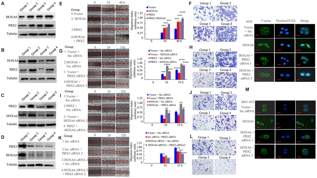 HOXA6 and PBX2 promote the migration and invasion of gastric cancer cells. (A) The expression of vector (group 1), or HOXA6 (group 2), or PBX2 (group 3), or HOXA6 plus PBX2 (group 4) in AGS stable transfectants cells detecting by western blot assay. (B) The expression of vector plus scrambled siRNA (Scr siRNA, group 1), or HOXA6 plus Scr siRNA (group 2), or vector plus PBX2 siRNA 2 (group 3), or HOXA6 plus PBX2 siRNA 2 (Group 4) in AGS transfectants cells at protein level as detected. (C) The expression of vector plus Scr siRNA (group 1), or PBX2 plus Scr siRNA (group 2), or vector plus HOXA6 siRNA 2 (group 3), or PBX2 plus HOXA6 siRNA 2 (Group 4) in AGS transfectants cells measuring by western blot analysis. (D) The expression of Scr siRNA (group 1), or Src siRNA plus PBX2 siRNA 2 (group 2), or HOXA6 siRNA 2 plus Src siRNA (group 3), or HOXA6 siRNA 2 + PBX2 siRNA 2 was subjected to western blot analysis. (E–L) GC cells were evaluated by wound healing and transwell invasion assays. Photographs show cell migration into the wounded area, and the data shows the percentage of wound closure in the histogram. Photographs show the cells that travelled through the micropore membrane. **, p M) The F-actin filaments of GC cells staining with rhodamine-phallotoxin for 48h were observed by fluorescence microscopy. Scale bars in M represent 20 μm.