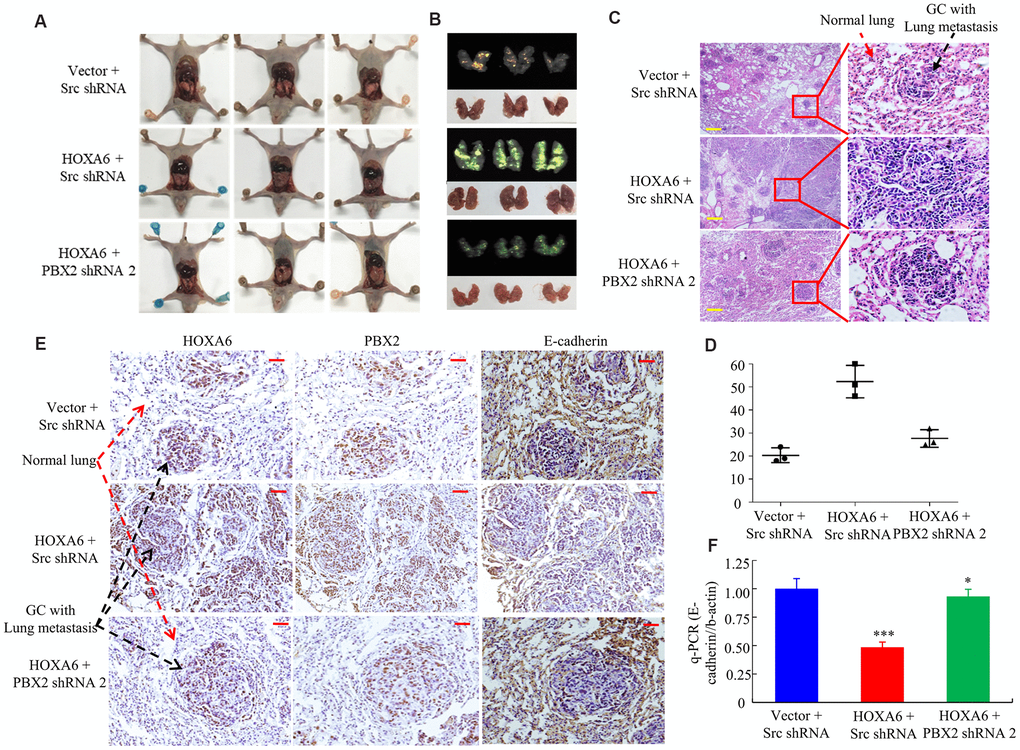 In vivo, HOXA6 synergizes with PBX2 to accelerate tumour metastasis. (A, B) All mice were sacrificed 4 weeks after tail vein injection of vector, HOXA6 + Src shRNA or HOXA6 + PBX2 shRNA 2. (A) and whole-body white light images. (B) orthotopic tumours from mice lung metastases. (C) Haematoxylin and eosin (H&E) staining of lungs was performed in samples from mice. (D) Metastatic lesions in the lung were counted. (E) The expression of HOXA6, PBX2 and E-cadherin in the lung metastasis of GC was detected through immunohistochemistry method. (F) E-cadherin expression in tumours derived from AGS cells was detected by qPCR. ***, P  0.05, vector versus HOXA6-PBX2 shRNA. Scale bars in C and E represent 100 μm.
