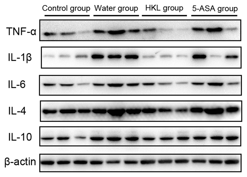 HKL inhibited expression of inflammatory factors at protein level. UC rats were treated with water, 5-ASA and HKL for 7 days. Colon tissues were harvested for western blot analysis. Each experiment was repeated in three samples.