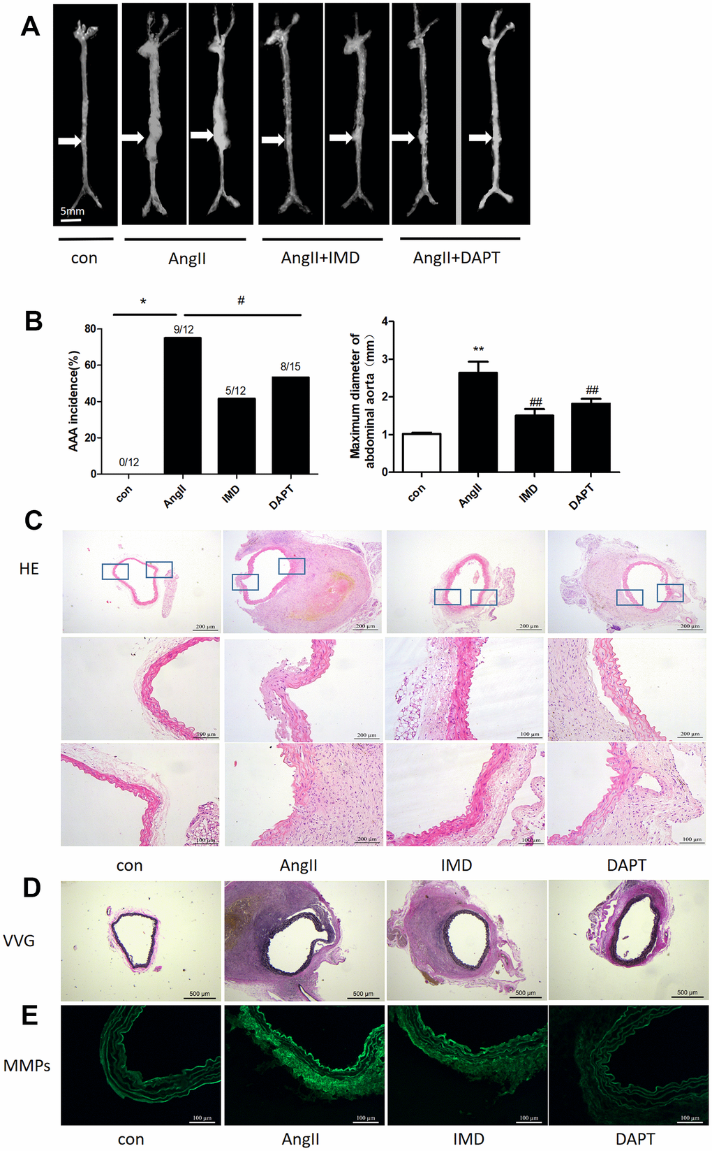IMD alleviated AngII-induced AAA in mice by blocking Notch1 signaling. (A) Representative photographs of macroscopic features of AAA in male ApoE-/- mice. Control, saline infusion; AngII, AngII (1000 ng/kg/min) infusion; AngII+IMD (300 ng/kg/min) infusion; AngII+DAPT (10 mg/kg) gavage for 4 weeks. The arrows indicate typical AAA in ApoE-/- mice. Scale bars, 5 mm. (B) Incidence of AngII-induced AAA in animals and maximal abdominal aortic diameter of survivor mice at the end of 28 days. (C) Representative HE staining of aortas. Scale bar, 200 μm, 100 μm. (D) Representative VVG staining. Scale bar, 500 μm. (E) Representative in situ zymography of MMP activity in suprarenal aortas from ApoE-/- mice. Scale bar, 100 μm. Data are mean ± SD. *PP