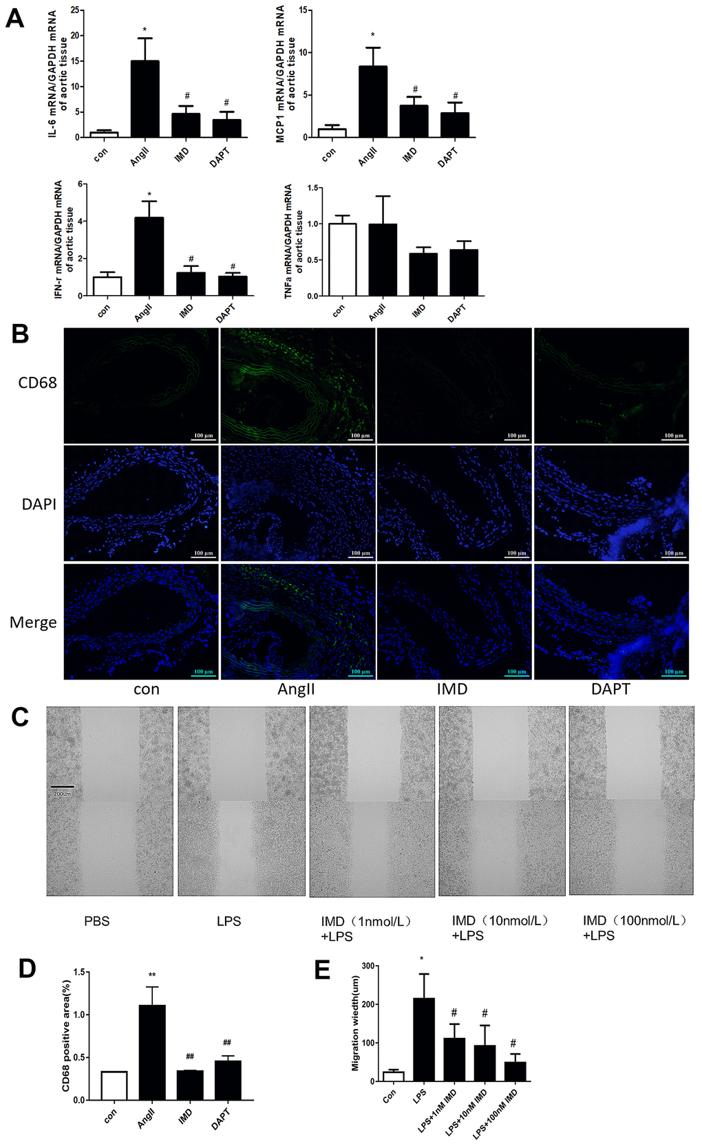 IMD inhibited macrophage-mediated inflammation via Notch1 signaling. (A) Quantitative real-time PCR of mRNA levels of IL-6, MCP-1, IFN-γ and TNF-α in aortas of Control, AngII, AngII+IMD and AngII+DAPT mice. (B) Representative immunofluorescence analysis of the protein expression of CD68 (green) and DAPI (blue) in aortas of mice. Scale bar, 100 μm. (C) Scratch-wound test to detect the transfer ability of mouse peritoneal macrophages in vitro. PBS, control group; LPS, stimulated group (100 ng/mL, 12 h). IMD was pretreated with a concentration gradient (1, 10, 100 nmol/L, 1 h). Cell migration distance was observed at 12 h after scratch wounding. Scale bar, 200 μm. n=3. (D) Quantification of (B). n=3, Data are mean ± SD. **P##PE) Quantification of scratch-wound test. n=3, Data are mean ± SD. *P#P