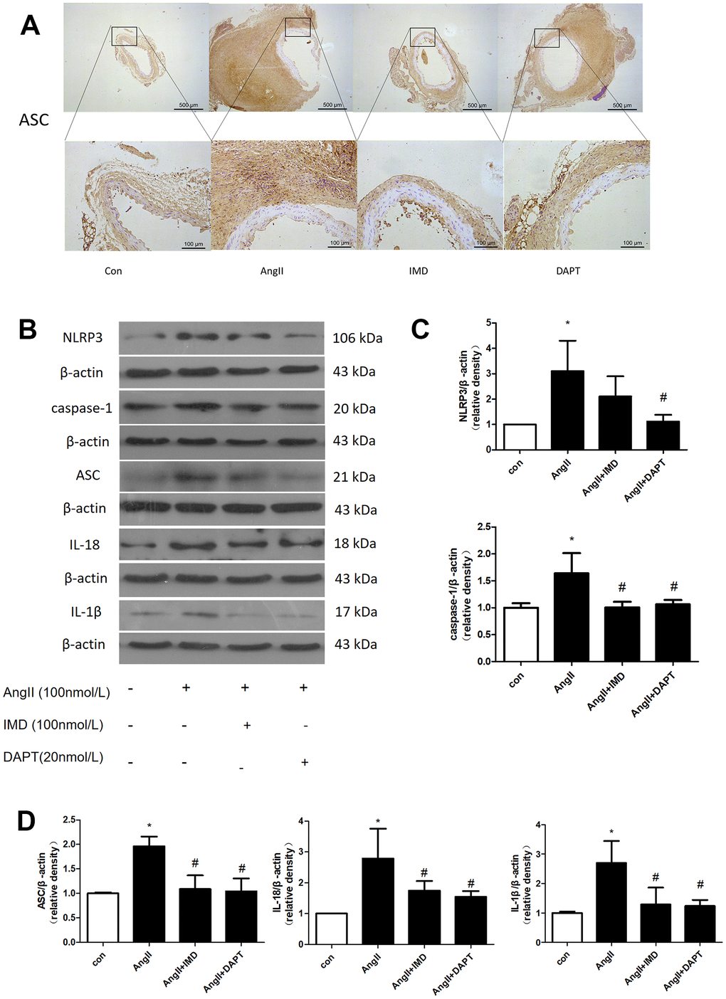 NLRP3 inflammasome activation was inhibited by IMD via Notch1 signaling. (A) Immunohistochemistry analysis of the protein expression of ASC in aortas of Control, AngII, AngII+IMD and AngII+DAPT mice. Control, saline infusion; AngII, AngII (1000 ng/kg/min) infusion; AngII+IMD (300 ng/kg/min) infusion; AngII+DAPT (10 mg/kg) gavage for 4 weeks. Scale bar, 500 μm, 100 μm. Boxes and arrows show enlarged areas. (B) Western blot analysis of protein levels of NLRP3, ASC, caspase-1, IL-1β, IL-18 in Raw264.7 macrophage cell line. The cell line was exposed to PBS, AngII (100 nm, 1 h) and DAPT (20 nm, 1 h). (C, D) Quantification of (B). n=3, Data are mean ± SD. *P#P