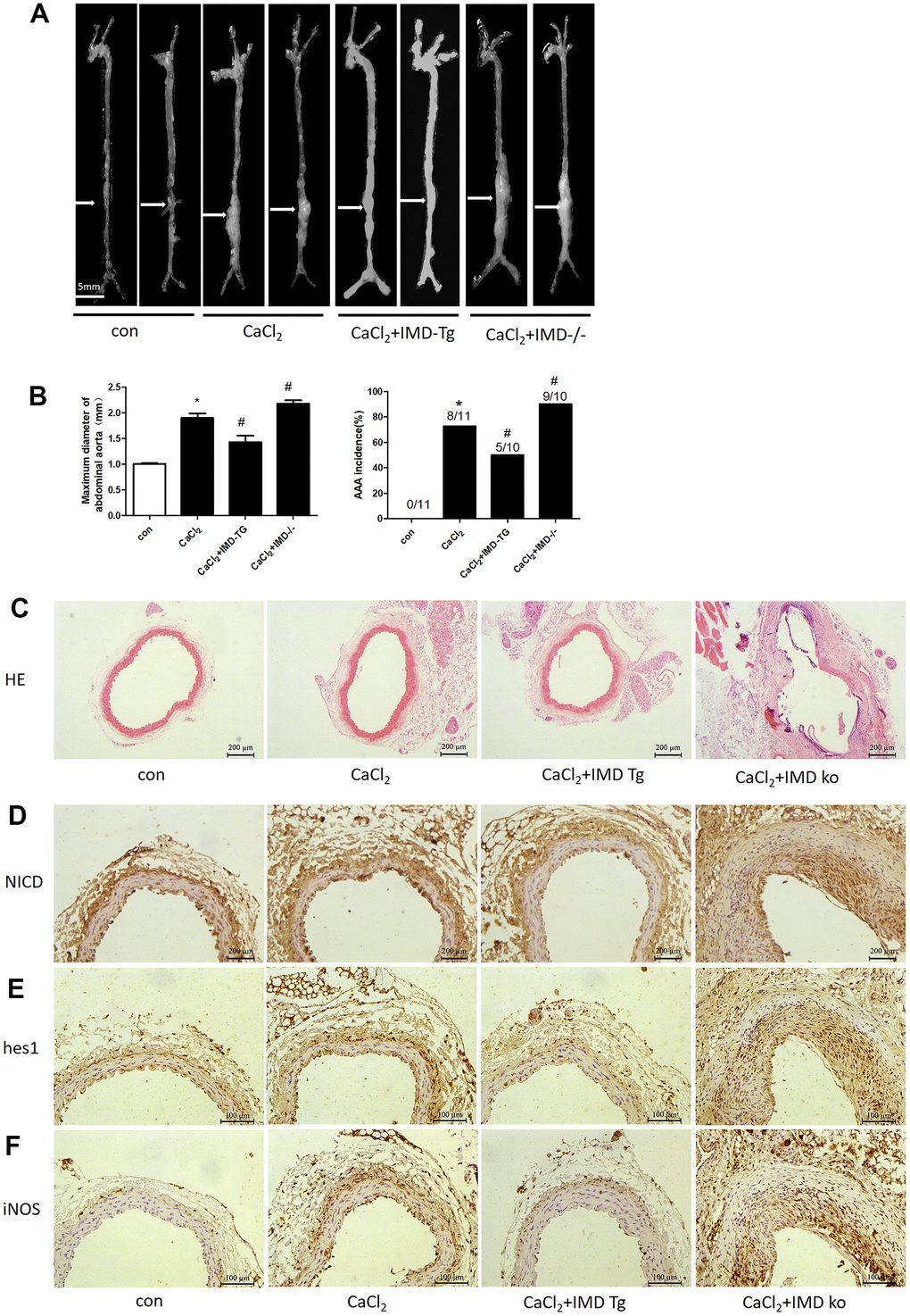 Endogenous IMD alleviated CaCl2-induced AAA and Notch1 signaling and M1 polarization. Control, wild type C57 mice with saline incubation; CaCl2, wild-type C57 mice with CaCl2 incubation; CaCl2+IMD-Tg, IMD transgenic mice with CaCl2 incubation to induce AAA; CaCl2+IMD ko, IMD-knockout mice with CaCl2 incubation to induce AAA. (A) Representative photographs of macroscopic features of aneurysms in male C57 mice at the end of 28 days. Scale bar, 5 mm. (B) Incidence of CaCl2-induced AAA in animals and maximal abdominal aortic diameter of surviving mice at the end of 28 days. The vascular diameter > 50% of the average diameter of the control group was considered AAA. *P#P2. (C) Representative HE staining. Scale bar, 200 μm. (D–F) Immunohistochemistry of the protein expression of NICD, hes1 and iNOS in aortas of mice.