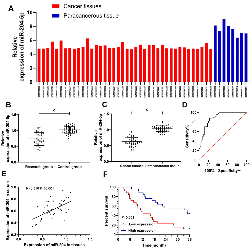 Clinical value of miR-204 in gallbladder carcinoma. (A) The expression of miR-204 in gallbladder carcinoma was decreased as detected by microarray; (B) The expression of miR-204 in patients serum from the study group was significantly decreased; (C) ROC curve of serum miR-204 in diagnosing gallbladder carcinoma, and the AUC was 0.884. When the cut-off value was 0.914, the optimal specificity, sensitivity and youden index was 78.00%, 88.00%, and 66.00%, respectively; (D) Expression of miR-204 in tissues was decreased; (E) Correlation analysis between miR-204 in serum and in tissues; (F) Patients with low expression of miR-204 showed a significantly lower 3-year survival rate than those with high expression (P=0.001). c indicates p