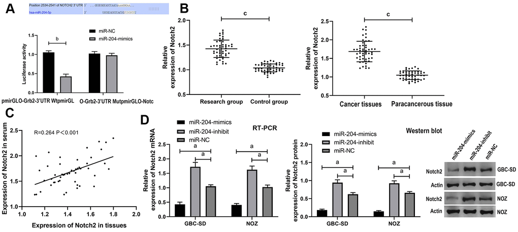 Verification of targeting relationship between miR-204 and Notch2. (A) DLR assay verified the targeting relationship between miR-204 and Notch2; (B) Expression of Notch2 protein in tissues and serum of the patients; (C) Correlation analysis between miR-204 in serum and in tissues of the patients; (D) Expression of Notch2 mRNA and protein in cells transfected with miR-204. a indicates ppp