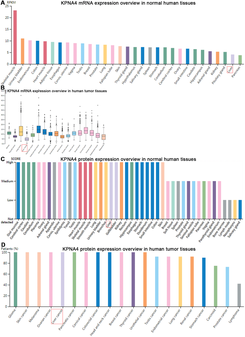 Gene and protein expression profiles of KPNA4 in human normal and tumor tissues in HPA database. (A) mRNA expression data from the GTEx project. (B) Gene expression in common human tumor tissues. (C) Protein expression of normal tissues in different organs. (D) Protein expression overview in common tumors.