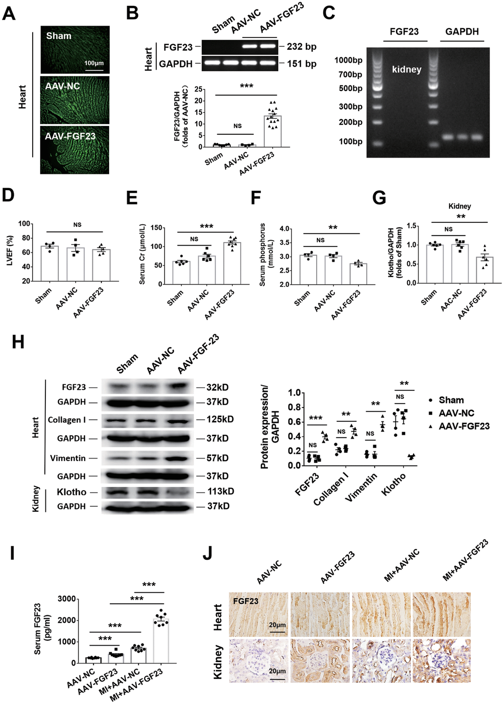 Cardiac overexpression of FGF23 enhanced cardiac fibrosis and renal dysfunction. (A) The results of frozen sections showed that adeno-associated virus (AAV) carrying the FGF23 plasmid or negative control (NC) successfully infected the heart. (B) Confirmation of FGF23 overexpression in mouse hearts. Myocardial FGF23 mRNA was measured by routine and real-time PCR 4 weeks later. ***P C) Expression of FGF23 mRNA was not detected in the kidneys. (D) Left ventricular ejection fraction (LVEF) showed no statistical significance between the groups. Serum creatinine (E) and serum phosphorus (F) levels were measured by ELISA. **P ***P G) Routine PCR and quantitative real-time PCR for Klotho mRNA in the kidneys. **P H) Western blot of FGF23, collagen I and Klotho in the heart and kidneys. **P ***P I) Serum FGF23 was measured by ELISA. ***P J) Immunohistochemical detection of FGF23 expression in the heart and kidneys of mice with or without cardiorenal syndrome and injection of AAV-NC or AAV-FGF23. Data are means ± SE.