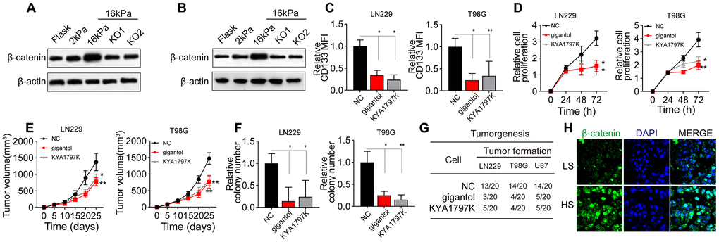 Wnt/β-catenin signaling was activated in glioma cells cultured on high-stiffness gels. (A) Western blotting analysis of β-catenin expression in LN229 cells cultured on gels of different stiffness levels with or without BCL9L shRNA treatment. (B) Western blotting analysis of β-catenin expression in T98G cells cultured on gels of different stiffness levels with or without BCL9L shRNA treatment. (C) Flow cytometry analysis of CD133 expression in LN229 or T98G cells cultured on 16-kPa stiffness gels and treated with PBS, gigantol (100 μM, 72 h) or KYA1797K (25 μM, 72 h). (D) Proliferation of LN229 or T98G cells treated with PBS, gigantol (100 μM, 72 h) or KYA1797K (25 μM, 72 h) and cultured on 16-kPa stiffness gels. (E) Tumor volumes were measured at various time points in mice injected with LN229 or T98G cells that had been treated with PBS, gigantol (100 μM, 72 h) or KYA1797K (25 μM, 72 h) and cultured on 16-kPa stiffness gels. (F) Cell colony formation of LN229 or T98G cells treated with PBS, gigantol (100 μM, 72 h) or KYA1797K (25 μM, 72 h) and cultured on 16-kPa stiffness gels. (G) Tumorigenesis of mice subcutaneously injected with 104 LN229 or T98G cells that had been pre-treated with PBS, gigantol (100 μM, 72 h) or KYA1797K (25 μM, 72 h) and cultured on 16-kPa stiffness gels. (H) Immunofluorescence analysis of β-catenin expression in tissues derived from the HS and LS groups. Scale bar, 50 μm. *P 