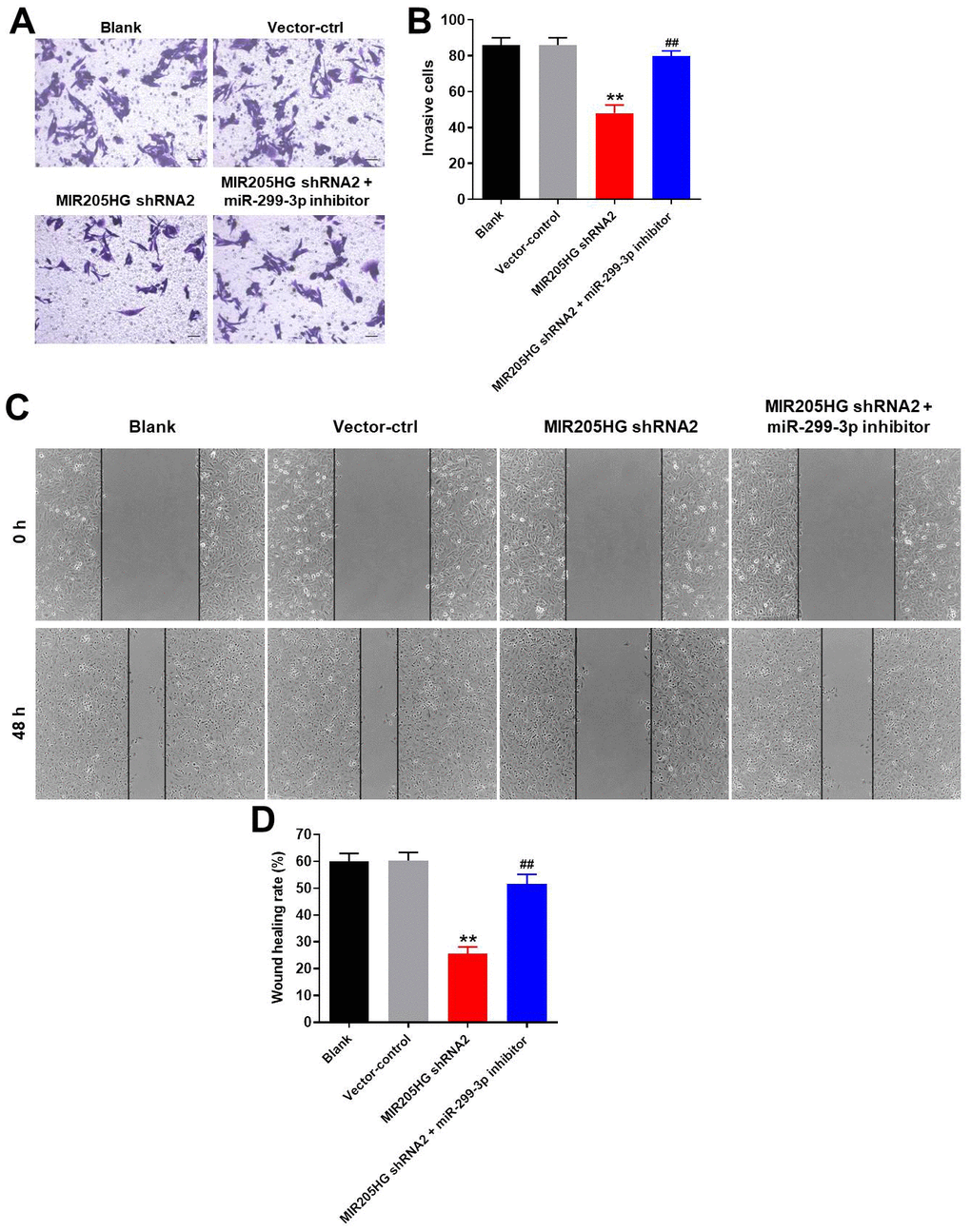 MIR205HG knockdown inhibits migration and invasion of melanoma cells. (A, B) Transwell assay results show the invasiveness of A375 cells transfected with MIR205HG shRNA2 or MIR205HG shRNA2 + miR-299-3p inhibitor. (C, D) Wound healing assay results show the migration ability of A375 cells transfected with MIR205HG shRNA2 or MIR205HG shRNA2 + miR-299-3p inhibitor. All experiments were performed thrice. **P##P