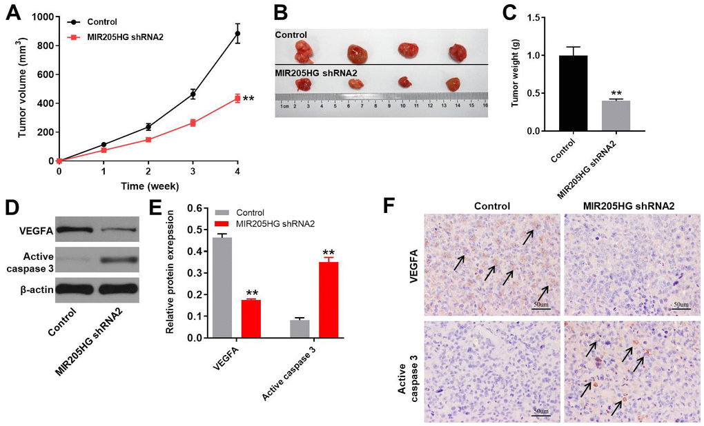 In vivo growth of melanoma is inhibited by MIR205HG silencing. (A) Tumor volumes in nude mice subcutaneously injected with control and MIR205HG shRNA2-transfected A375 cells. Tumor volumes were measured weekly. (B) Representative images show the xenograft tumors in nude mice at 4 weeks after subcutaneously injecting control or MIR205HG shRNA2-transfected A375 cells. (C) Tumor weights in nude mice subcutaneously injected with control and MIR205HG shRNA2-transfected A375 cells (n=4 per group). (D, E) Western blot analysis shows the expression levels of VEGFA and cleaved caspase3 in xenograft tumor tissues harvested from nude mice subcutaneously injected with control and MIR205HG shRNA2-transfected A375 cells. The relative protein expression levels were quantified by normalizing to endogenous β-actin as the loading control. All experiments were performed thrice. (F) The expressions of active caspase 3 and VEGFA in tumor tissues of mice were detected by IHC staining. Black arrows indicate the positive cells after IHC staining. **P