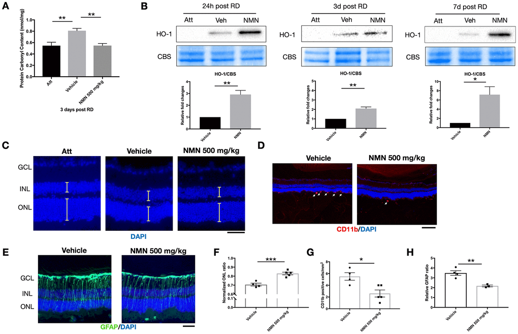 NMN administration attenuates oxidative stress and is protective in the late phase of retinal detachment (RD). (A) Protein carbonyl content (PCC) was significantly higher after RD while NMN treatment normalized PCC level comparable to the attached retinas at three days post RD. N = 6 eyes per group. (B) Heme oxygenase 1 (HO-1) was significantly up-regulated in the NMN groups as soon as 24h and remained highly expressed throughout the experimental period. N = 4 to 5 eyes per group. (C–F) Preservation of outer nuclear layer (ONL) thickness after NMN administration was seen 7 days after RD. N = 4 to 5 eyes per group. Scale bar=50 μm. The thickness of the layers was measured as the yellow lines indicated. (D–G) Inhibition of neuroinflammation seen by a reduced number of CD11b+ infiltrating macrophages (red) in NMN-treated retinas compared to vehicle-treated retinas. N = 4 to 5 eyes per group. Scale bar: 100 μm. (E–H) Reduced reactive gliosis represented by GFAP (green) staining in NMN-treated retinas compared to vehicle-treated retinas. N = 3 to 4 eyes per group. Scale bar: 50 μm. Statistical significance was analyzed with one-way ANOVA followed by Tukey-Kramer adjustments or the unpaired Student's t-test. *p