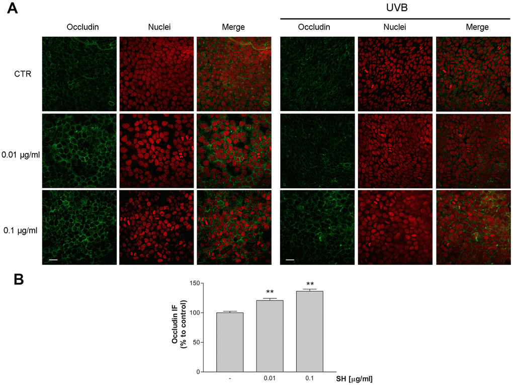 Effect of Salvia haenkei extract 0.01 and 0.1 μg/ml on occludin in HaCaT cells before and after exposure to UVB radiation (30KJ/m2). (A) Images were collected by confocal laser-scanning microscope LSM800 and software ZEN 2.1, magnification 60X and are representative of at least 3 experiments. Scale bar = 20μm. (B) Quantitative analysis of occludin fluorescence intensity (related to area) in cells treated with SH. Results are the mean ± SEM of 3-5 experiments. **pvs control.